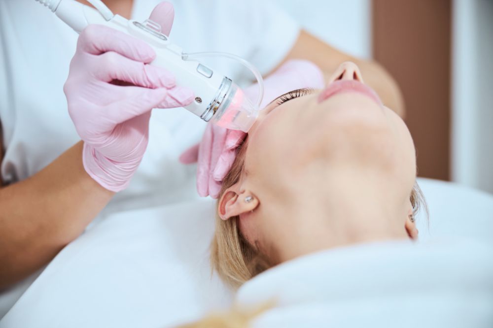 benefits and side effects of microneedling